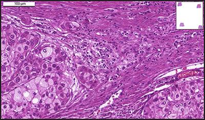 Whole Slide Imaging and Its Applications to Histopathological Studies of Liver Disorders